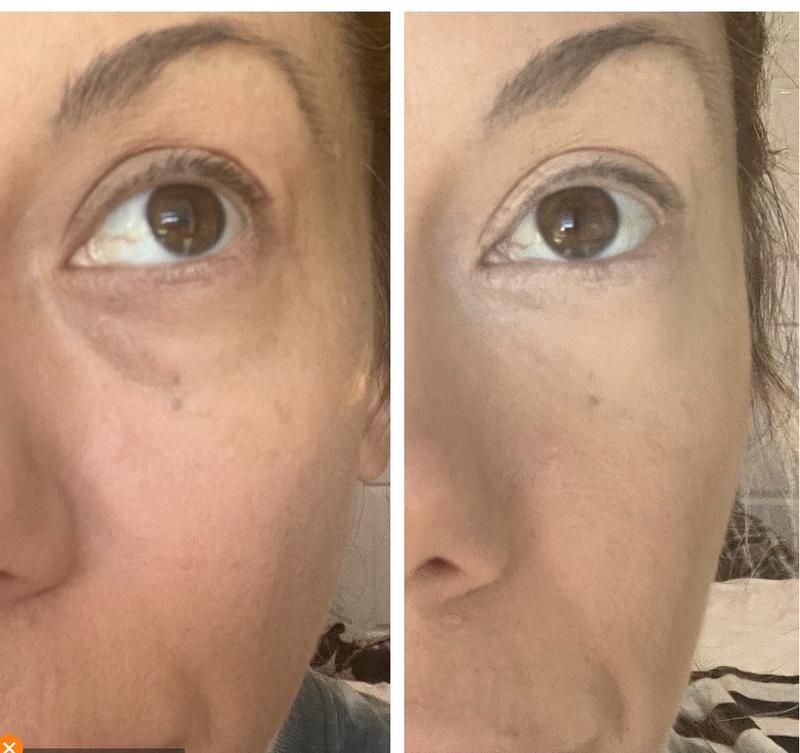 Gel, Effet Lifting Instantané | Aivalya™