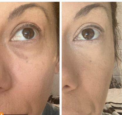 Gel, Effet Lifting Instantané | Aivalya™